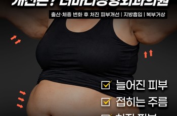 복부거상이란? 출산과 다이어트 후 늘어진 복부, 개선 방법부터 …